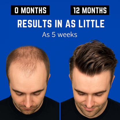 Hair Revival Hat™ V3